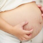 Кожные заболевания во время беременности
