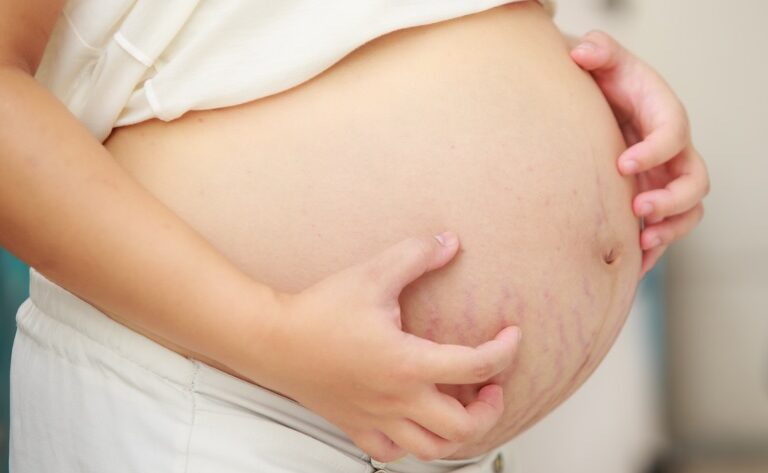 Кожные заболевания во время беременности