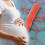 Листерия и беременность