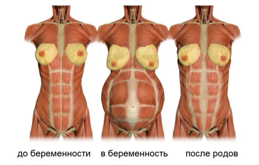 Мышцы живота во время беременности
